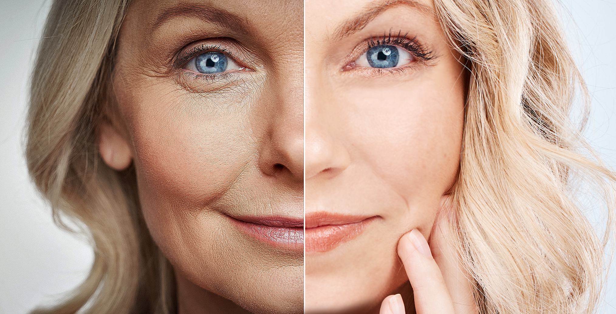 holistyczna medycyna estetyczna twarz przed i po